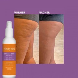 SLIMMY MINI ANTI - CELLULITE Serum, Tagescreme und Nachtcreme. Für die effektive Bekämpfung gegen Cellulite!
